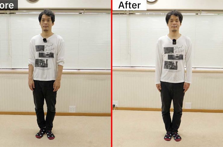 姿勢改善ビフォーアフター正面