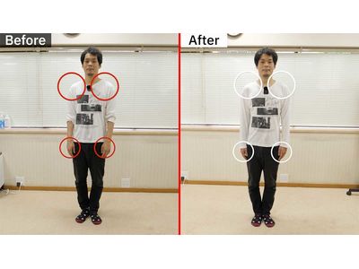 姿勢改善ビフォーアフター正面マーク付き