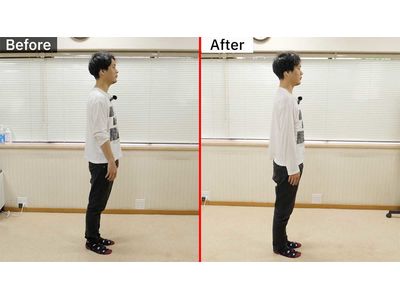 姿勢改善ビフォーアフター右向き