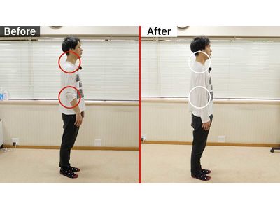 姿勢改善ビフォーアフター右向きマーク付き