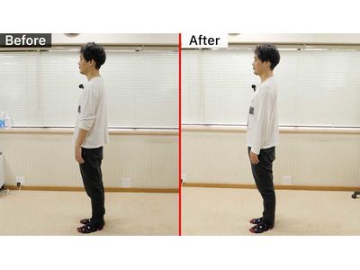 姿勢改善ビフォーアフター左向き