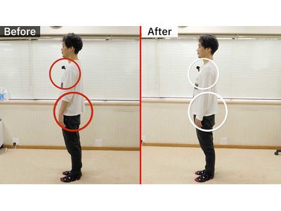 姿勢改善ビフォーアフター左向きマーク付き