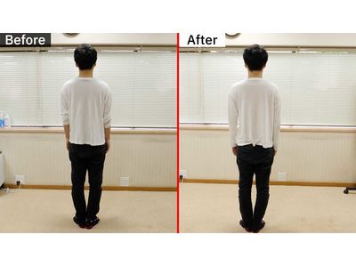 姿勢改善ビフォーアフター後ろ向き